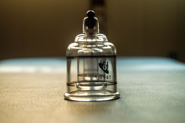 Tratamiento con ventosas en WindSalud Tarifa